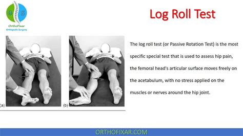 hip drop test|log roll hip exam.